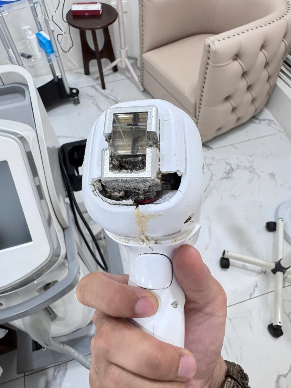Dịch Vụ Sửa Máy Triệt Lông Diode Laser - Giá Rẻ Chỉ Từ 200k lấy ngay tại Nhà 2 tay cầm máy triệt lông diode laser bị cháy